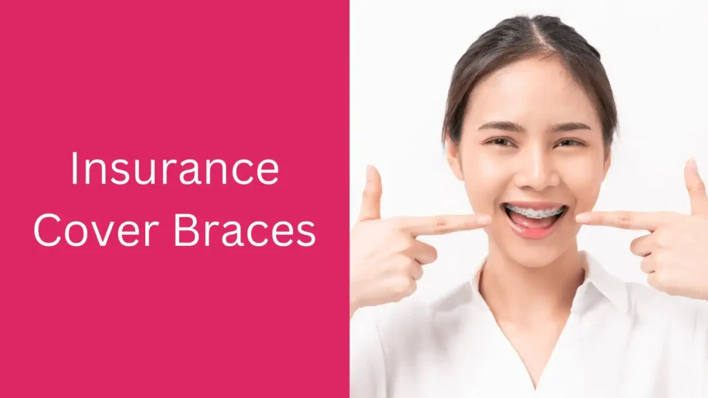 Does Insurance Cover Braces